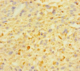 ZSCAN29 Antibody