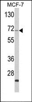 ZYG11A antibody