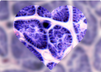 Cardiac Markers