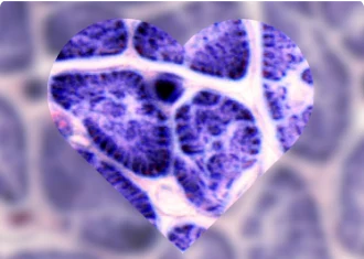 Cardiac Markers