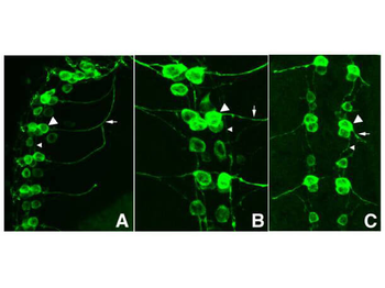 GFP and EGFP green fluorescent protein expression in live cells