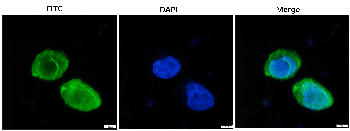 mCherry red fluorescent protein visualization in cell structures