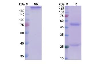 Andecaliximab orb1237874 的 SDS-PAGE，含非还原与还原条件