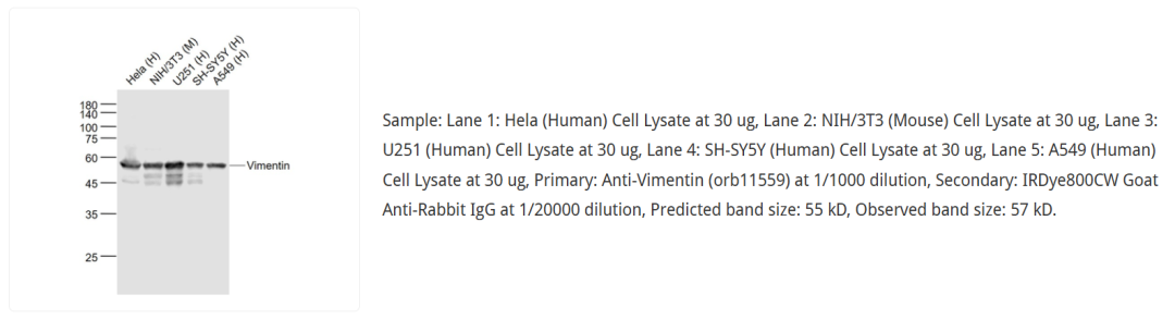 orb11559 Western Blot：Hela、NIH/3T3、U251、SH-SY5Y、A549