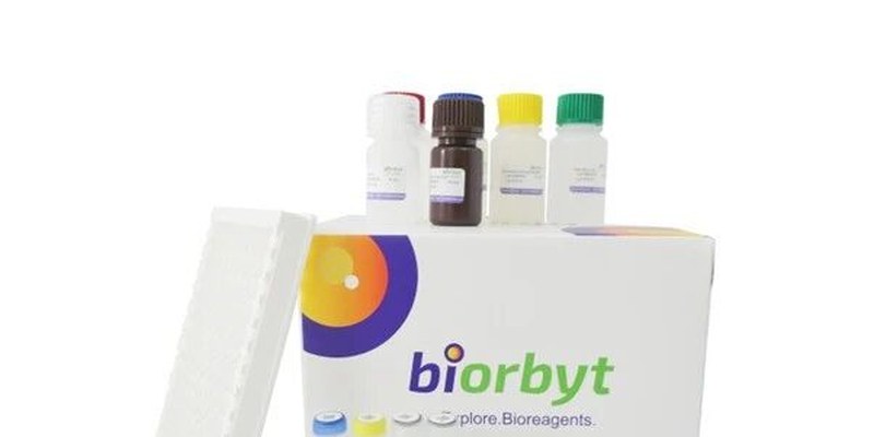 Biorbyt定性ELISA kit